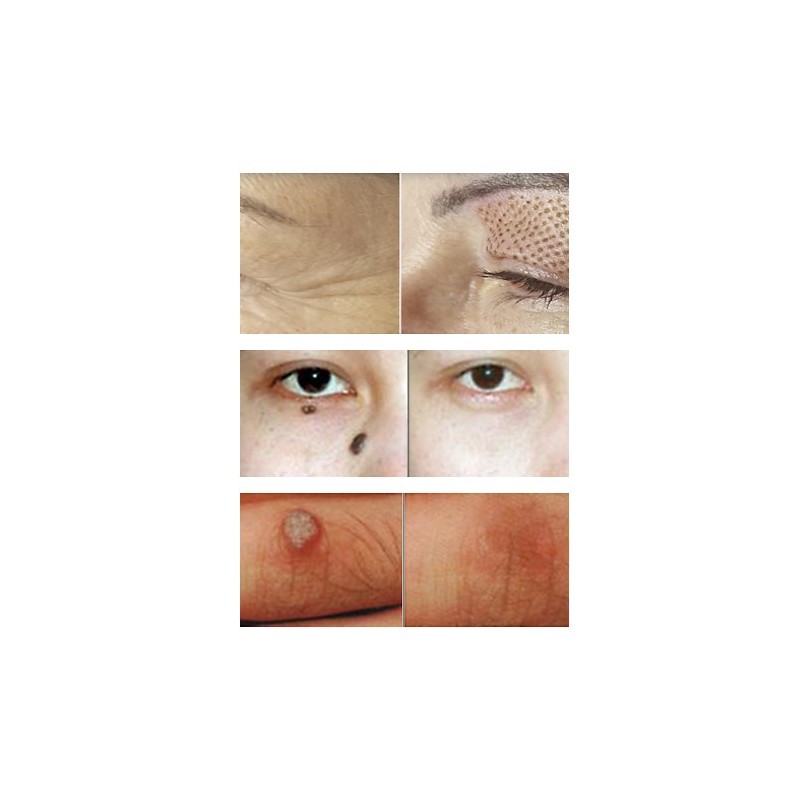 Urządzenia podnoszące - Wysyłka 1gr | EVERSUN